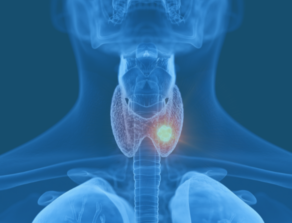 Thyroid Cancer Location