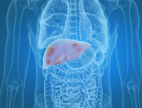 Liver Cancer Location