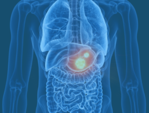 Stomach Cancer Location