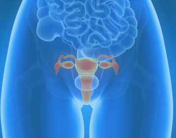 Cervical Cancer Location Cervical Cancer Location