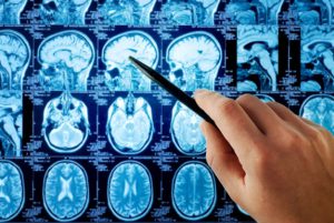 brain-scans