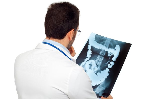 Doctor Examines Colorectal x-ray