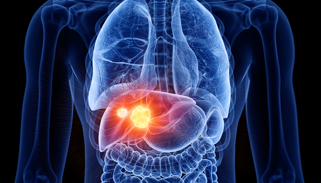 research about cancer of the liver