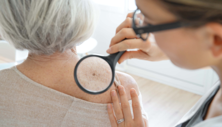Melanoma 101: What You Need to Know - NFCR Skin Cancer Info