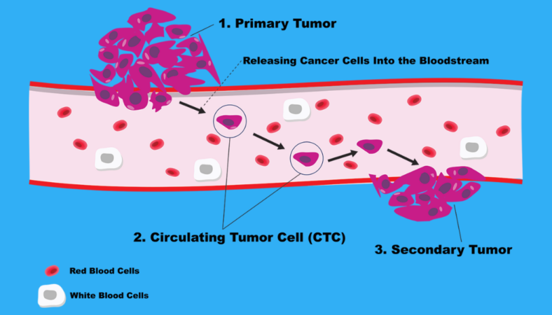 Circulating Tumor Cell Inforgraphic