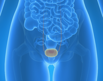bladder-cancer bladder-cancer