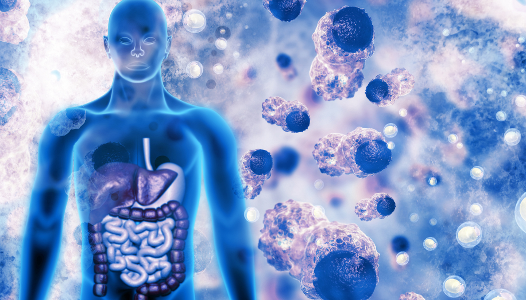 Cancer Formation