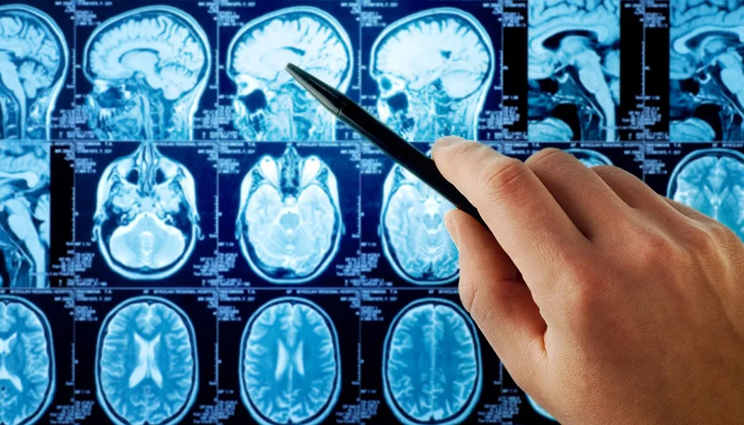 Brain Cancer Treatment alternatives