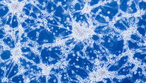 glioblastoma achilles heel