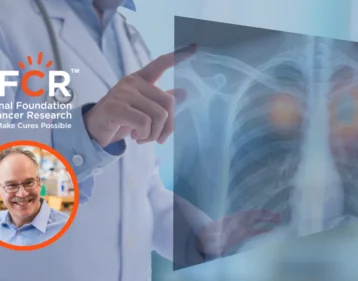 Progress in Precision Treatment for Small Cell Lung Cancer Thanks to NFCR Support Progress in Precision Treatment for Small Cell Lung Cancer Thanks to NFCR Support